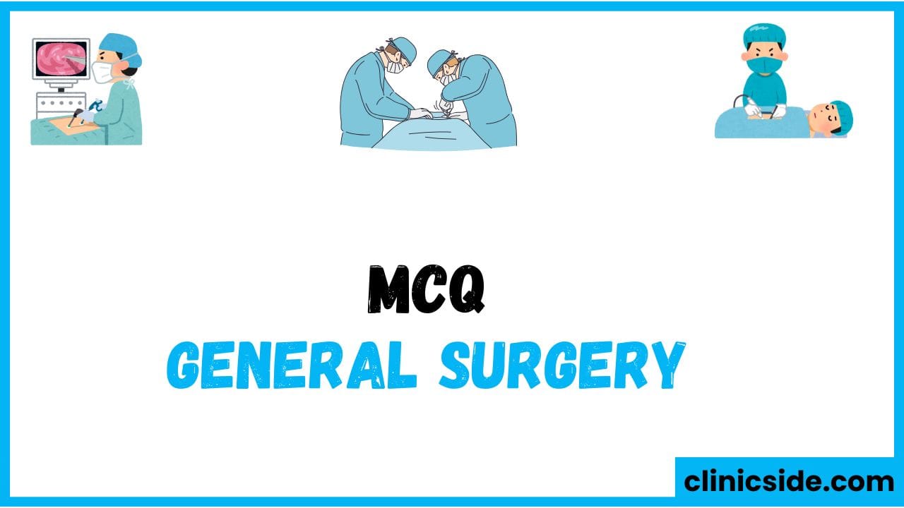 General Surgery: 10 Essential MCQs  for Preparation