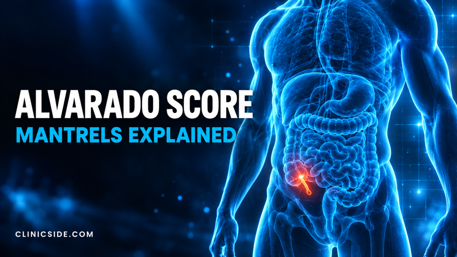 Alvarado score thumbnail showing a glowing holographic torso with an inflamed appendix in electric blue